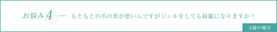 もともとの爪の形が悪いんですがジェルをしても綺麗になりますか？